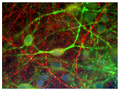 Immunofluorescence of cultured rat CNS cells showing specific labeling of neuronal processes with Anti-alpha-internexin (Cat. 100-AIN, 1:250, red), and specific labeling of perikarya and dendrites with anti-microtubule associated protein 2 (Cat. 1100-MAP2,1:2,500,green).