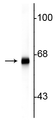 Western blot of rat cortex lysate showing specific immunolabeling of the ~66 kDa alpha internexin protein.