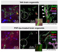Representative 3D view images of paired helical filament (PHF)-tau-treated human brain organoid fractions. The organoids were labeled for MAP2 (Cat. 1100-MAP2, 1:1000, green), NR3A (red), PSD95 (magenta), and DAPI (blue). White arrows show the positions colocalized between PSD95 and NR3A. The dotted circles show the magnified positions. Scale bar = 10 or 3 μm. Image from publication, CC-BY-4.0. PMID: 39396906