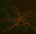 Immunolabeling of mouse hippocampal cultures labeled with anti-MAP2 (Cat. 1100-MAP2, 1:1000, red) and anti-synapsin (Cat. 1925-SYNP , 1:1000, green).