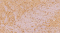 Immunostaining of a sagittal section of FFPE rat brain showing strong staining of oligodendrocyte precursor cells (OPC) in the hippocampus using our anti-NG2/CSPG4 (DAB, 1:200) and detected with anti-rabbit HRP. The section is counterstained with hematoxylin to identify DNA (blue).