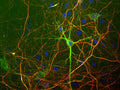 Immunostaining of mixed cultured rat neurons and glia stained with anti-NFH antibody (Cat. 1451-NFH, red, 1:25,000) and anti-NFL antibody (Cat. 1452-NFL, green, 1:100).