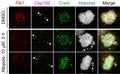 Confocal imaging and quantification of Plk1 signal intensities at centrosomes and kinetochores (Cat. 15-234) after treating HeLa cells with DMSO or 10 μM of Allopole for 2 h. Arrowheads, centrosomes; arrows, misaligned chromosomes. Signal intensities were quantified from both centrosome signals and randomly chosen three to four kinetochore signals per cell for a total of greater than or equal to 18 cells/experiment. Image from publication CC-BY-4.0. PMID:37603740