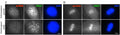 Representative images of heterozygous (top) and homozygous (bottom) fibroblasts stained with AURKB (C, prophase) or survivin (metaphase, D) (red; shown in grayscale) and FITC-conjugated CREST (Cat. 15-235-F, 1:100, green; shown in grayscale). Image from publication CC-BY-4.0. PMID:28272472