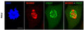 Immunofluorescence staining of fibroblasts shows partial and transient localization of WDR62 (red) in prometaphase kinetochores (CREST, cat. 15-235-F, 1:100). Image from publication CC-BY-4.0. PMID:28272472