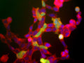 Immunolabeling of HEK 293 cells labeled with anti-neuron specific enolase antibody (Cat. 1520-NSE, red, 1:500) and anti-UCHL1 antibody (Cat. 2060-UCHL1, green, 1:500).