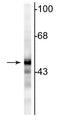 Western blot of rat cortical lysate showing specific immunolabeling of the ~47 kDa NSE protein.