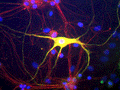 Immunoflourescence of cultured rat neurons and glia showing peripherin (Cat. 1631-PER, green, 1:500) and alpha-internexin (red). The blue stain is nuclear DNA. Cells expressing both peripherin and alpha-internexin appear yellow.