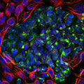 Immunoflourescence of mixed fibroblasts and PC12 cells labeled with anti-peripherin (Cat. 1631-PER, green, 1:5000) and anti-vimentin (red). The blue is DAPI staining nuclear DNA. Peripherin is labeled in only the PC12 cells