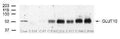 Western Blot showing specific immunolabeling of GLUT10 in Lane 1: 10ug of protein from liver Lane 2: 10ug of protein from cochlea (E18) Lane 3: 10ug of protein from cochlea (P7) Lane 4: 10ug of protein from cochlea (P10) Lane 5: 10ug of protein from cochlea (P14) Lane 6: 10ug of protein from cochlea (P17) Lane 7: 10ug of protein from cochlea (P60) Lane 8: 10ug of protein from cochlea (1 Year).