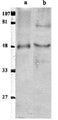 Western Blot of purified EAPII protein (a) and Human Cancer cell line (b) showing specific immunolabeling of ETS1 associated protein II.