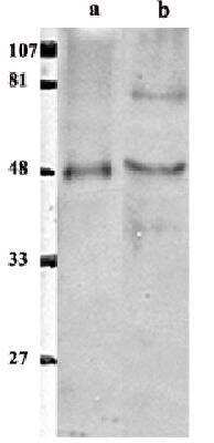 Western Blot of purified EAPII protein (a) and Human Cancer cell line (b) showing specific immunolabeling of ETS1 associated protein II.