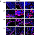 Immunostaining of normal ovarian and tumor tissue sections showing specific labeling of CD133. Staining of CD133 in OSE layer (A, B) as well as cortex (C) reveals specific CD133+ cells with relatively higher cell numbers in BL and HG. Area within dotted lines in BN OSE (A) are magnified in (B) while elliptical/spindle shaped CD133+ cells in cortex from various fields were represented in the composite image in (C) of BN and HG. Large CD133+ cells in cortex were also observed. Image from the following publ
