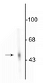 Western blot of rat adrenal medulla showing specific immunolabeling of the ~55 kDa DDC protein.