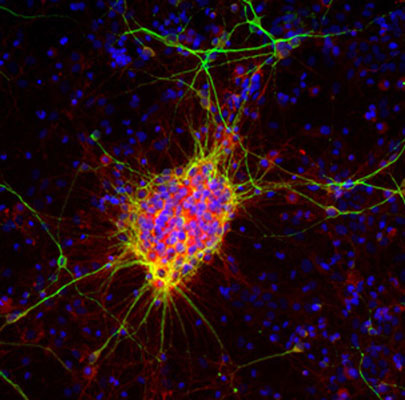 Immunofluorescence of rat cortical neuron-glial cells showing strong cytoplasmic labeling of a small population of developing neurons and their processes with Anti-DCX (Cat. 451-DCX, 1:1000, red) while Anti-MAP2 (Cat. 1100-MAP2, 1:10,000, green) labels dendrites and perikarya or mature neurons, and additional nuclear staining was done with DAPI (blue). Anti-doublecortin is an excellent marker of early developing neuronal cells.