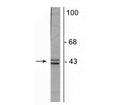 Western blot of postnatal day 3 rat brain lysate showing specific immunolabeling of the ~35 kDa and ~45 kDa doublecortin protein.