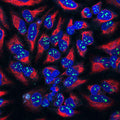 High magnification confocal image of HeLa cells showing strong, prominent labeling of the nucleoli in the nucleus with Anti-Fibrillarin (Cat. 560-FIB, 1:100, green), colabeled with Anti-Vimentin (Cat. 2105-VIM, red, 1:1000) showing the cytoplasmic intermediated filaments, and nuclear staining was done with DAPI (blue).