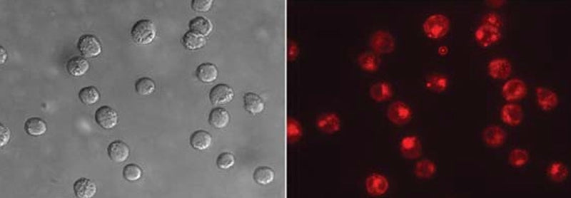Figure 2. Jurkat cells were treated with staurosporine to induce apoptosis, then labeled with SR-VAD-OPH for 60 minutes. Cells were washed twice and wet-mount slides were prepared. A grey DIC image (left) was taken, and red fluorescence (right) was detected using a band pass filter (excitation at 565 nm, emission at 590-600 nm). SR-VAD-OPH reveals complete caspase activation in the form of red fluorescence in all cells. Data courtesy of Ms. Tracy Hanson, ICT (ICT111809; SR_OPH_111_17_18).