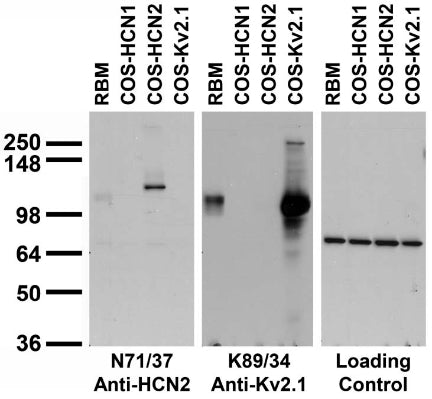 Adult rat brain membrane (RBM) and transfected cell immunoblot: extracts of RBM and of COS-1 cells transfected with GFP- HCN1, GFP-HCN2 or Kv2.1 plasmids and probed with N71/37 (left), K89/34 (middle) or a control (right) TC supe.