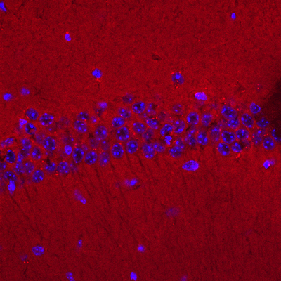 Immunolabeling of mouse hippocampus identifying GluR2 (Cat no 75-002, red). Nuclear staining done with DAPI.  Image kindly provided by Huaye Zhang, Department of Neuroscience and Cell Biology, Rutgers Robert Wood Johnson Medical School. 