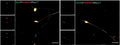 Induced pluripotent stem cell-derived sensory neurons (iPSC-SNs) stained positively for peripherin (a marker of peripheral neurons), Brn3a (a marker of sensory neurons48), NeuN (a marker of neuronal nuclei), and NaV1.7 (Cat. 75-103, 1:250). Image from publication CC-BY-4.0. PMID:34930944