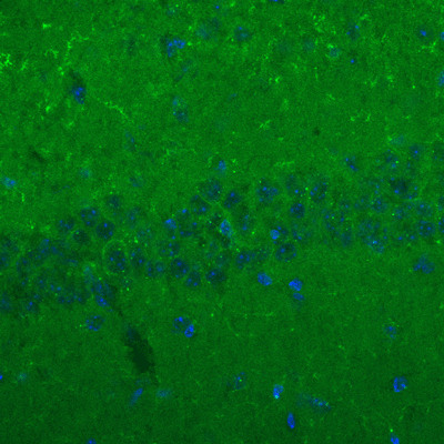 Immunolabeling of mouse hippocampus identifying GKAP (Anti-SAPAP,  Cat no 75-156, green). Nuclear staining done with DAPI. Image kindly provided by Huaye Zhang, Department of Neuroscience and Cell Biology, Rutgers Robert Wood Johnson Medical School.