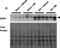 Western blot showing a band at the molecular weight corresponding to GFAP (Cat. 75-240, 1:1000) in vehicle- or B9-treated sham and injured mice (top panel). The bottom panel shows the total protein loaded on each lane, which was used for normalization. Image from publication CC-BY-4.0. PMID:38302457