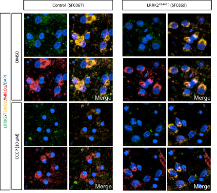 iPSC-DA neuronal cultures from control and LRRK2R1441C patient lines were treated with DMSO or CCCP (24 h, 10 μM) then fixed, stained for LRRK2 (Cat. 75-253, 1:100), TOM20 and MIRO1. Image from publication CC-BY-4.0. PMID:37384414