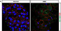 Confocal images stained for Arl13b (Cat. 75-287, 1:2000; green) and ZO-1 (red) of healthy human RPE and AMD patient. Image from publication CC-BY-4.0. PMID:37211572