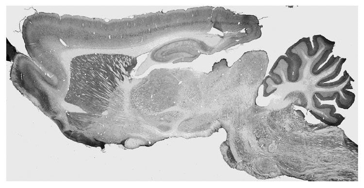 Adult rat brain immunohistochemistry (with antigen retrieval via sodium citrate pretreatment).
