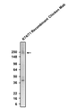 Western blotting of rat brain membrane with anti-Nav1.1 (SCN1A) recombinant chicken mAb (Cat. 78-023) antibody. The chicken mAb was detected with anti-chicken-HRP (Cat. 80-1000-HRP). Aves Labs Recombinant Chicken anti-Nav1.1 mAb recognizes endogenous Nav1.1 in the rat brain membrane fraction at ~220 kDa.