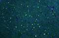Representative section of formalin fixed, paraffin-embedded rat brain stem neurons stained by anti-PTEN Induced Putative Kinase 1 (PINK1) recombinant chicken monoclonal antibody using goat anti-chicken IgY CF®488 secondary antibody (Cat No. 80-1001-488) (visualized in green). The stained sections were mounted with Antibodies Incorporated Fluoroshield with DAPI and DABCO mounting medium (Cat No. AR-6505). DAPI nuclear stain (blue) shows cell nuclei.