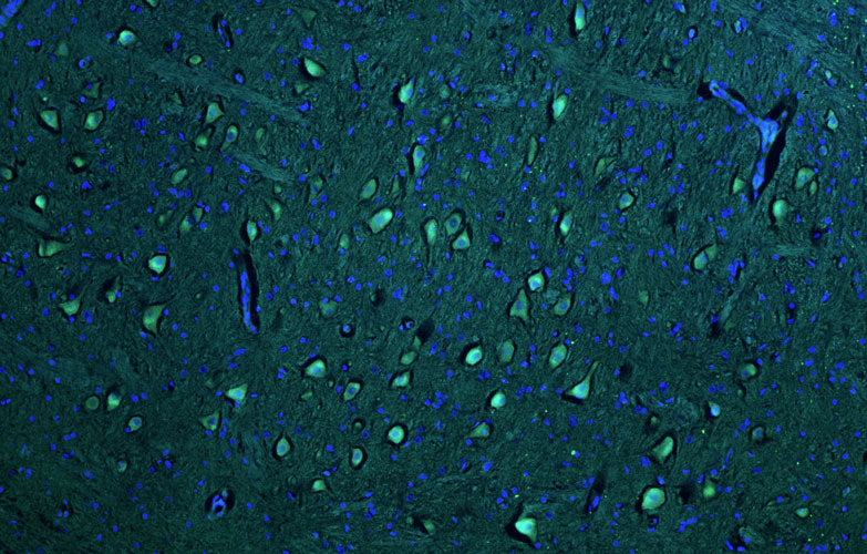 Representative section of formalin fixed, paraffin-embedded rat brain stem neurons stained by anti-PTEN Induced Putative Kinase 1 (PINK1) recombinant chicken monoclonal antibody using goat anti-chicken IgY CF®488 secondary antibody (Cat No. 80-1001-488) (visualized in green). The stained sections were mounted with Antibodies Incorporated Fluoroshield with DAPI and DABCO mounting medium (Cat No. AR-6505). DAPI nuclear stain (blue) shows cell nuclei.