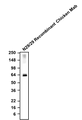 Western blotting of rat brain membrane fraction with Aves Labs anti-Vglut2 recombinant chicken m (Cat. 78-067) antibody and detected with anti-chicken-HRP. Aves Labs recombinant chicken anti-VGlut2 mAb recognizes endogenous Vglut2 in the rat brain membrane fraction