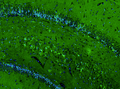 Representative section of formalin fixed, paraffin-embedded rat brain hippocampus showing neurons in CA4 region stained by anti-GluN2B recombinant chicken monoclonal antibody (Cat. 78-097) using goat anti-chicken IgY CF®488 secondary antibody (Cat. 80-1001-488) (visualized in green). The stained sections were mounted with Antibodies Incorporated Fluoroshield with DAPI and DABCO mounting medium (Cat. AR-6505). DAPI nuclear stain (blue) shows cell nuclei.