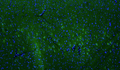 Representative section of formalin fixed, paraffin-embedded rat brain cerebral cortex showing cells stained by anti-LRRK2/Dardarin antibody. The sections were stained with Aves Labs anti-LRRK2 recombinant chicken monoclonal antibody (visualized in green, Cat No. 78-253). The stained sections were mounted with Antibodies Incorporated Fluoroshield with DAPI and DABCO mounting medium (Cat. AR-6505). DAPI nuclear stain (blue) shows cell nuclei.