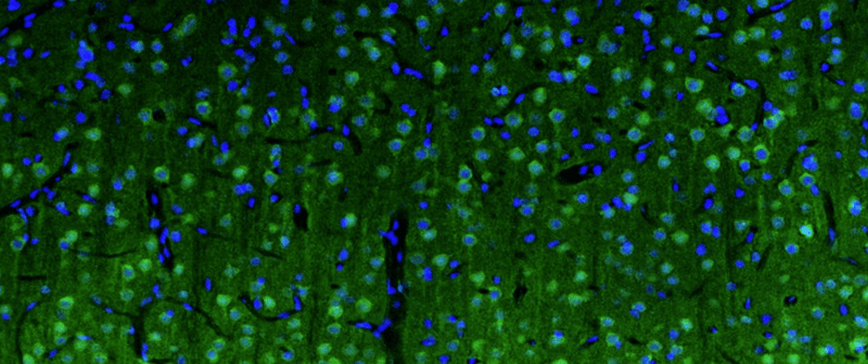 Representative section of formalin fixed, paraffin-embedded rat brain cerebral cortex showing cells stained by anti-Beta4 Spectrin recombinant chicken monoclonal antibody (green)  (Cat. 78-377). The stained sections were mounted with Antibodies Incorporated Fluoroshield with DAPI and DABCO mounting medium (Cat. AR-6505). DAPI nuclear stain (blue) shows cell nuclei. Anti-Beta4 Spectrin  specifically stains the neuronal body and axon initial segment (AIS) in the cerebral cortex Magnification 100X.