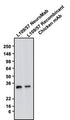 Western blotting of rat brain homogenate with Antibodies Incorporated anti-CALB1 (calbindin) mouse mAb (Cat. 75-448) and Aves Labs anti-CALB1 recombinant chicken mAb (Cat. 78-448) antibodies (10 µg/ml). The mouse Mab and chicken mAb were detected with anti-mouse-HRP and anti-chicken-HRP, respectively. Recombinant chicken anti-CALB1 mAb