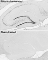 Immunohistochemistry staining of hippocampus region from adult rats treated with pilocarpine to induce seizures (top) and with saline (bottom) using anti-c-Fos antibody. The sections were stained with Antibodies Incorporated anti-c-Fos NeuroMab mouse monoclonal antibody (Cat. 75-506). The variable region of this antibody was used to generate recombinant chicken chimeric anti-c-Fos antibody (Cat. 78-506).