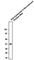 Western blotting of HeLa cell lysates with Aves Labs anti-Cytokeratin 8 (CK8) recombinant chicken mAb antibody at ~52 kDa. It was detected with anti-chicken-HRP (Cat No. 80-1000-HRP).