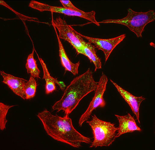Immunofluorescent staining of HeLa cells using Aves Labs anti-Mannose-6-Phosphate Receptor (M6PR) recombinant chicken monoclonal antibody (green). Actin filaments were stained using Phalloidin (red). The stained cells were mounted with Antibodies Incorporated Fluoroshield with DAPI and DABCO mounting medium (Cat No. AR-6505). DAPI nuclear stain (blue) shows cell nuclei. Anti-M6PR specifically stains the trans-Golgi network and endosomes in HeLa cells. 