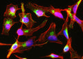 Immunofluorescent staining of HeLa cells using Aves Labs anti-Mannose-6-Phosphate Receptor (M6PR) recombinant chicken monoclonal antibody (green). Actin filaments were stained using Phalloidin (red). The stained cells were mounted with Antibodies Incorporated Fluoroshield with DAPI and DABCO mounting medium (Cat No. AR-6505). DAPI nuclear stain (blue) shows cell nuclei. Anti-M6PR specifically stains the trans-Golgi network and endosomes in HeLa cells. 