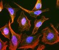 Immunofluorescent staining of HeLa cells using Aves Labs anti-Rab9 recombinant chicken monoclonal antibody (green). Actin filaments were stained using Phalloidin (red). The stained cells were mounted with Antibodies Incorporated Fluoroshield with DAPI and DABCO mounting medium (Cat No. AR-6505). DAPI nuclear stain (blue) shows cell nuclei. Anti-Rab9 specifically stains the late endosomes in HeLa cells. 