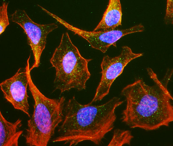Immunofluorescent staining of HeLa cells using Aves Labs anti-Rab9 recombinant chicken monoclonal antibody (green). Actin filaments were stained using Phalloidin (red). The stained cells were mounted with Antibodies Incorporated Fluoroshield with DAPI and DABCO mounting medium (Cat No. AR-6505). DAPI nuclear stain (blue) shows cell nuclei. Anti-Rab9 specifically stains the late endosomes in HeLa cells. 