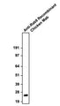 Western blotting of HeLa cell lysates with Aves Labs Rab9 recombinant chicken monoclonal antibody at ~23 kDa. The mAb was detected with anti-chicken-HRP (Cat No. 80-1000-HRP).