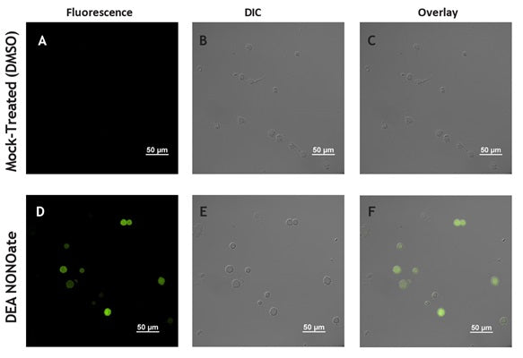 Figure 2. Jurkat suspension cells were stained with DAF-2DA dye, washed, and then treated with DMSO control (Panels A-C) or DEA NONOate (Panels D-F), a nitric oxide donor. Cells treated with DEA NONOate showed an increased level of green fluorescence relative to the untreated cells (Panels A v and D). Microscope images were obtained using a Nikon Eclipse 90i microscope with a Hamamatsu Flash 4.0 camera. Data courtesy of Dr. Kristi Strandberg (ICT 228:57-58).