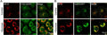 Localization of EGFP-tagged V-ATPase proteins in stably expressing NRK cells. (A and B) Confocal fluorescence images of untreated (control) clonal cells expressing V1G1-EGFP (A) or Voa3-EGFP (B) or cells incubated with 30 mM sucrose for 24 h were incubated with Magic Red cathepsin B substrate (MR B) for 2 min before imaging. Image from publication. CC-BY-4.0 PMID: 38446621