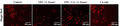 Effect of CA on cathepsin B release in S. sonnei-infected macrophages. The cathepsin B activity was analysed by Magic Red staining (Cat. 937) and acquired by fluorescent microscopy. Image from publication, CC-BY-4.0. PMID: 38840105