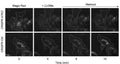 Time-lapse images of Magic Red-labeled MCF7-p95ErbB2 CRISPR-A7KO and CRISPR-Ctrl cells transfected with Ctrl siRNA and pulse-treated with LLOMe (1.5 mM). Image from publication. CC-BY-4.0, PMID: 38348092