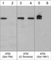 Immunocytochemical labeling of ATM phosphorylation in calyculin A-treated A431 cells. The cells were labeled with rabbit polyclonal anti-ATM (Ser-794) (AP3631) antibody in the absence (Left) or presence (Right) of blocking peptide (AX3635). The antibody was detected using appropriate secondary antibody conjugated to DyLight® 594.